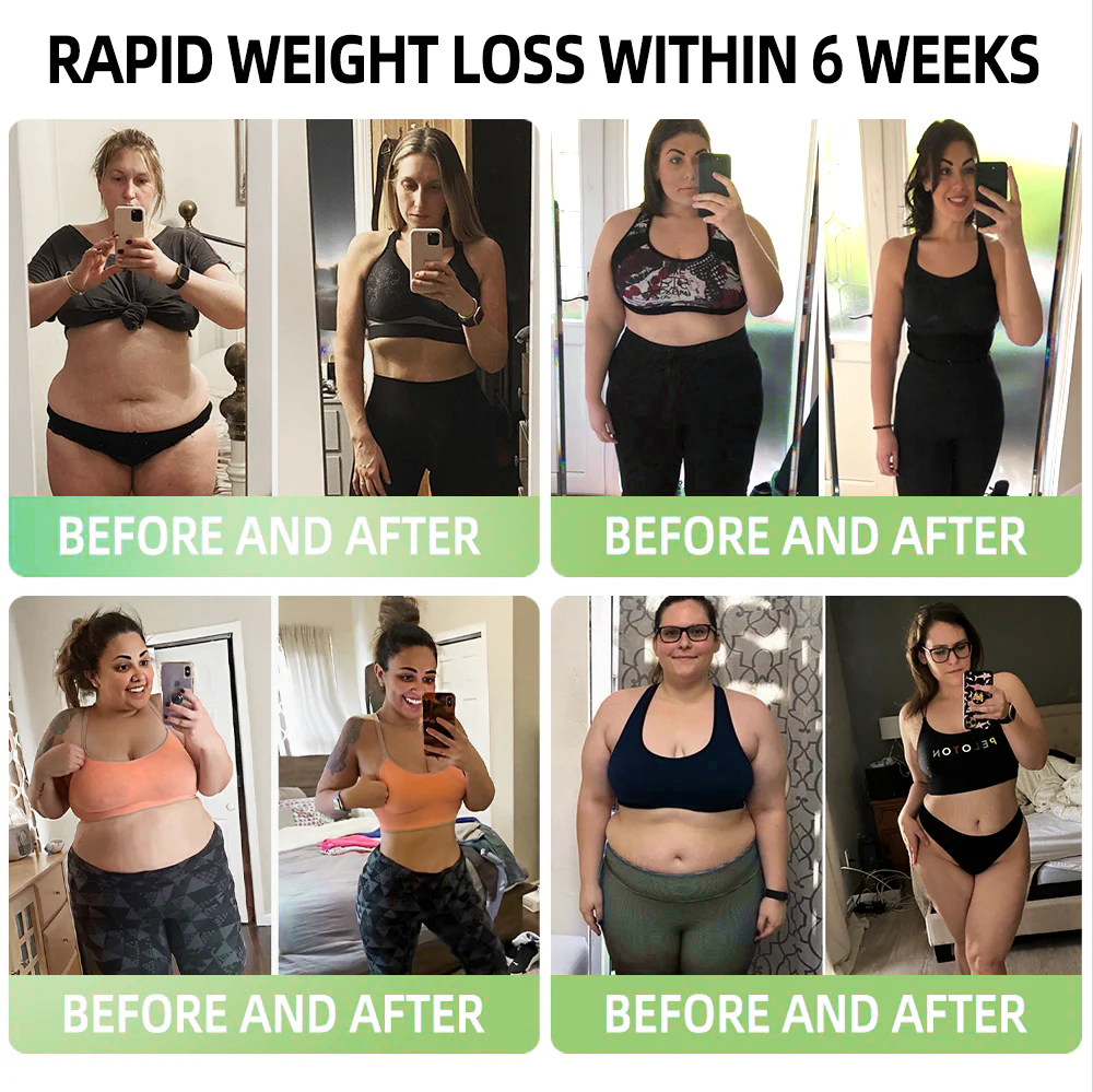 ✅Official Store💎Cvreoz® GLP-1 Meglutide Diet Drops - Designed for Weight Loss | 👨‍⚕️Recommended by 𝐇𝐚𝐫𝐯𝐚𝐫𝐝 𝐌𝐞𝐝𝐢𝐜𝐚𝐥 𝐒𝐜𝐡𝐨𝐨𝐥 丨 Made & Shipped From Canada Fast-Acting, Healthy Weight Loss to Transform Your Body!🌞