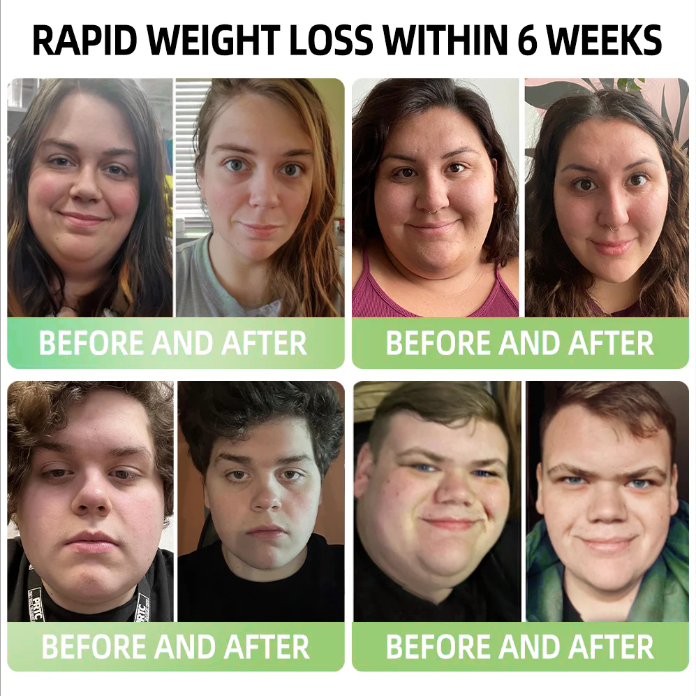 ✅Official Store💎Cvreoz® GLP-1 Meglutide Diet Drops - Designed for Weight Loss | 👨‍⚕️Recommended by 𝐇𝐚𝐫𝐯𝐚𝐫𝐝 𝐌𝐞𝐝𝐢𝐜𝐚𝐥 𝐒𝐜𝐡𝐨𝐨𝐥 丨 Made & Shipped From Canada Fast-Acting, Healthy Weight Loss to Transform Your Body!🌞