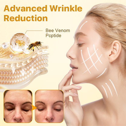 Cvreoz® Official Store BotoxLux Bee Venom Lifting Cream✅Certified by the Australian Society of Cosmetic Dermatology (ASCD)👨‍⚕️1